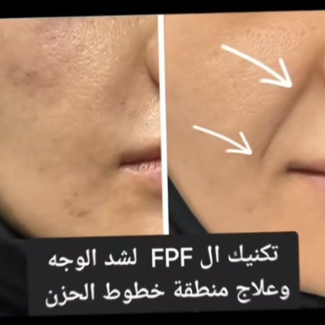 قبل وبعد 2